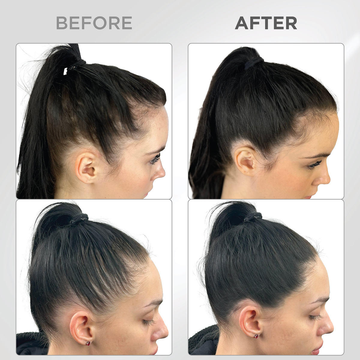 Unaltered brand-supplied Black shade hairline application examples, preserving the original before-and-after human result photographs.
